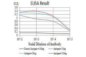 Black line: Control Antigen (100 ng),Purple line: Antigen (10 ng), Blue line: Antigen (50 ng), Red line:Antigen (100 ng) (IL2 Receptor beta Antikörper  (AA 27-240))