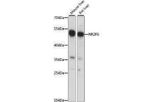 Western blot analysis of extracts of various cell lines, using NR2F6 antibody. (NR2F6 Antikörper)