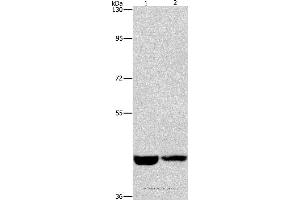 Western blot analysis of Hela and A431 cell, using CSNK1E Polyclonal Antibody at dilution of 1:1550
