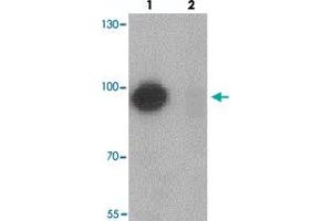 Western blot analysis of TSHZ1 in A-20 cell lysate with TSHZ1 polyclonal antibody  at 1 ug/mL in (lane 1) the absence and (lane 2) the presence of blocking peptide. (TSHZ1 Antikörper  (N-Term))