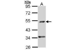 WB Image Sample (30 ug of whole cell lysate) A: A431 , 10% SDS PAGE antibody diluted at 1:1000 (PDSS2 Antikörper)