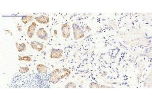 Immunohistochemistry of paraffin-embedded Human stomach tissue using JAK3 Polyclonal Antibody at dilution of 1:200. (JAK3 Antikörper)