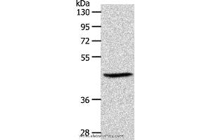 Western blot analysis of PC3 cell, using S1PR3 Polyclonal Antibody at dilution of 1:550 (S1PR3 Antikörper)