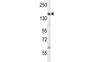 SRC-1 antibody western blot analysis in MDA-MB231 lysate. (NCOA1 Antikörper  (AA 594-625))