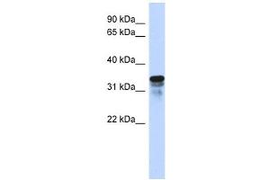 FAM82B antibody used at 1 ug/ml to detect target protein. (FAM82B Antikörper  (N-Term))