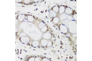 Immunohistochemistry of paraffin-embedded human gastric using CBX3 antibody (ABIN5971255) at dilution of 1/200 (40x lens). (CBX3 Antikörper)