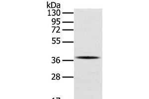 Western Blot analysis of A375 cell using SPARC Polyclonal Antibody at dilution of 1:400 (SPARC Antikörper)