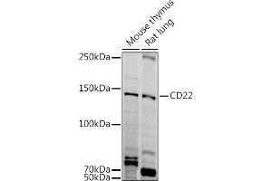 Western blot analysis of extracts of various cell lines, using CD22 antibody (ABIN6131253, ABIN6138143, ABIN6138144 and ABIN6221471) at 1:1000 dilution. (CD22 Antikörper  (AA 708-847))