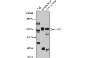 Western blot analysis of extracts of various cell lines, using RNF10 antibody (ABIN6128687, ABIN6147001, ABIN6147002 and ABIN6215902) at 1:1000 dilution. (RNF10 Antikörper  (AA 552-811))