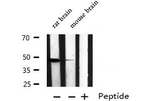 Western blot analysis of EDG2 expression in various lysates (LPAR1 Antikörper  (N-Term))