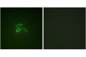 Immunofluorescence analysis of HepG2 cells, using CD227/MUC1 (Phospho-Tyr1229) Antibody. (MUC1 Antikörper  (pTyr1229))