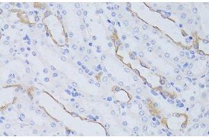 Immunohistochemistry of paraffin-embedded Mouse kidney using Aquaporin 4 Polyclonal Antibody at dilution of 1:50 (40x lens). (Aquaporin 4 Antikörper)