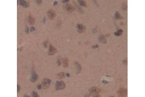 IHC-P analysis of Rat Tissue, with DAB staining. (SLIT2 Antikörper  (AA 209-374))
