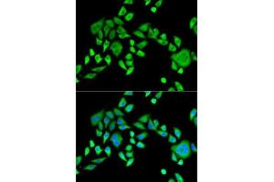 Immunofluorescence analysis of HeLa cells using SH3GL2 antibody (ABIN6132118, ABIN6147725, ABIN6147726 and ABIN6221363). (SH3G2 Antikörper  (AA 1-270))