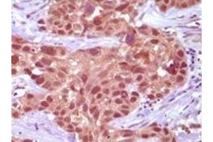 Immunohistochemistry (IHC) image for anti-Mismatch Repair Protein 2 (MSH2) antibody (ABIN2464085) (MSH2 Antikörper)