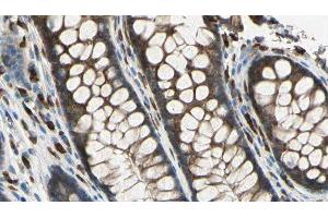 ABIN6278833 at 1/100 staining Rat colon tissue by IHC-P.