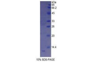 SDS-PAGE (SDS) image for Somatostatin (SST) (AA 27-116) protein (His tag) (ABIN2122120) (Somatostatin Protein (SST) (AA 27-116) (His tag))