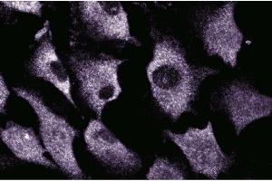 Immunofluorescent staining of EaHy cells. (SRPK1 Antikörper  (AA 312-434))