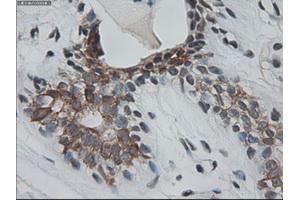 Immunohistochemical staining of paraffin-embedded breast using anti-KRT18 (ABIN2452646) mouse monoclonal antibody. (Cytokeratin 18 Antikörper  (AA 69-372))