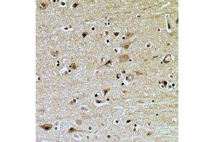 Immunohistochemical analysis of ZNRF2 staining in human brain formalin fixed paraffin embedded tissue section. (ZNRF2 Antikörper  (C-Term))