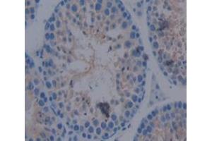 IHC-P analysis of Mouse Tissue, with DAB staining. (ACVR2A Antikörper  (AA 20-95))