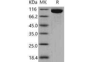 Toll-Like Receptor 3 (TLR3) protein (His tag)