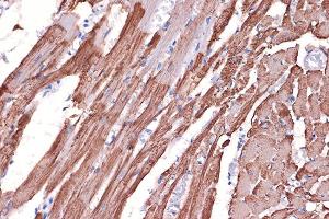 Immunohistochemistry of paraffin-embedded rat heart using Tropomyosin 1 Rabbit mAb (ABIN7271013) at dilution of 1:100 (40x lens).