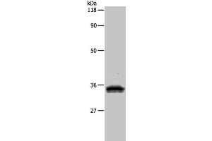 Western Blot analysis of 293T cell using UPK3B Polyclonal Antibody at dilution of 1:1000 (Uroplakin 3B Antikörper)