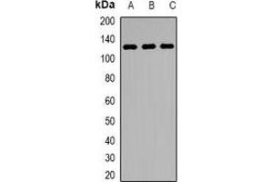 Western blot analysis of KDM1A expression in Jurkat (A), MCF7 (B), mouse testis (C) whole cell lysates.