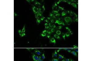 Immunofluorescence analysis of U2OS cells using TSHB Polyclonal Antibody (TSHB Antikörper)