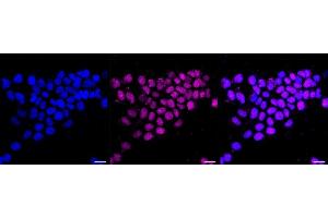 anti-SUMO1 Activating Enzyme Subunit 1 (SAE1) antibody