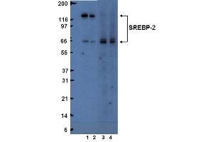 Western Blotting (WB) image for anti-Sterol Regulatory Element Binding Transcription Factor 2 (SREBF2) (AA 833-1141) antibody (ABIN967564) (SREBF2 Antikörper  (AA 833-1141))