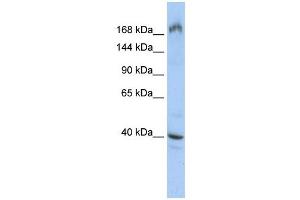 EIF4G1 antibody used at 1 ug/ml to detect target protein. (EIF4G1 Antikörper  (Middle Region))