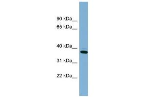 WB Suggested Anti-XAF1 Antibody Titration: 0. (XAF1 Antikörper  (Middle Region))