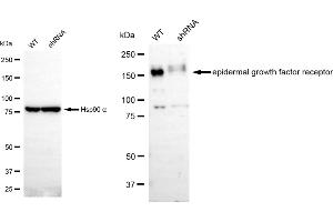 Western blotting analysis using EGFR antibody (ABIN7798479). (Rekombinanter EGFR Antikörper)
