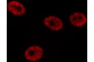 Immunofluorescence (fixed cells) (IF/ICC) image for anti-Nuclear Receptor Subfamily 1, Group I, Member 2 (NR1I2) (C-Term) antibody (ABIN6263716)