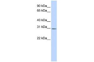 WB Suggested Anti-YIF1B Antibody Titration:  0. (YIF1B Antikörper  (Middle Region))