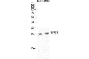Western Blot (WB) analysis of specific cells using SRp20 Polyclonal Antibody. (SRSF3 Antikörper  (C-Term))