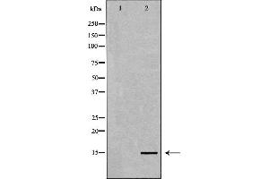 Western blot analysis of extracts of HeLa, using Histone H3K4me3 Antibody. (Histone 3 Antikörper  (H3K4me3))