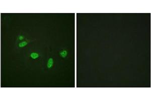 Immunofluorescence staining of methanol-fixed HeLa cells using ETS1 (Phospho-Thr38) Antibody. (ETS1 Antikörper  (pThr38))
