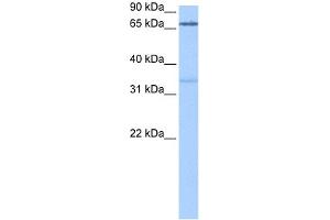 WB Suggested Anti-PADI2 Antibody Titration: 0.