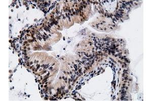 Immunohistochemistry (IHC) image for anti-EPM2A (Laforin) Interacting Protein 1 (EPM2AIP1) antibody (ABIN1498047) (EPM2AIP1 Antikörper)