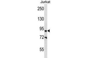 ZNF780B Antibody (N-term) western blot analysis in Jurkat cell line lysates (35 µg/lane). (ZNF780B Antikörper  (N-Term))