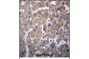 YIPF1 Antibody (N-term) (ABIN656786 and ABIN2846004) immunohistochemistry analysis in formalin fixed and paraffin embedded human liver tissue followed by peroxidase conjugation of the secondary antibody and DAB staining. (YIPF1 Antikörper  (N-Term))