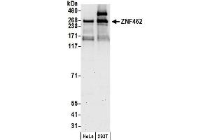 Western Blotting (WB) image for anti-Zinc Finger Protein 462 (ZNF462) (AA 2456-2506) antibody (ABIN7453414)