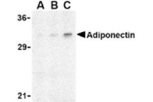 Image no. 1 for anti-Adiponectin (ADIPOQ) (N-Term) antibody (ABIN265161) (ADIPOQ Antikörper  (N-Term))