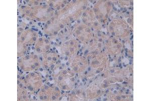 Used in DAB staining on fromalin fixed paraffin- embedded Kidney tissue (PCSK1 Antikörper  (AA 244-530))