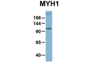 Host:  Rabbit  Target Name:  MYH1  Sample Type:  OVCAR-3  Antibody Dilution:  1. (MYH1 Antikörper  (N-Term))