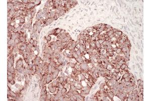 Immunohistochemistry (IHC) image for anti-Heat Shock 60kDa Protein 1 (Chaperonin) (HSPD1) (AA 300-350) antibody (ABIN7454874)