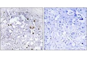 Immunohistochemistry (IHC) image for anti-Hepatocyte Nuclear Factor 4, alpha (HNF4A) (AA 280-329), (pSer313) antibody (ABIN1531864)